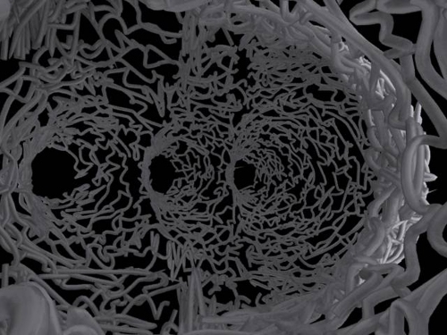 spleen22